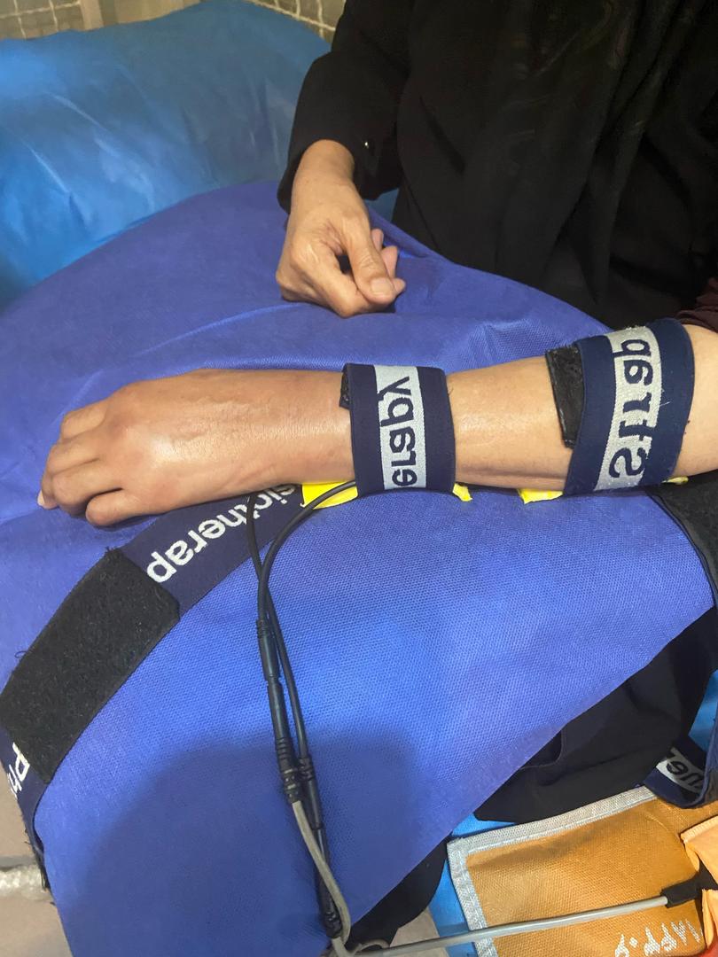 فیزیوتراپی در شکستگی مچ دست